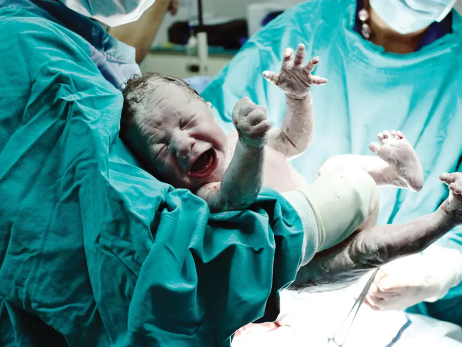 kopfumfang babys geburt - Bei welchem Kopfumfang Kaiserschnitt