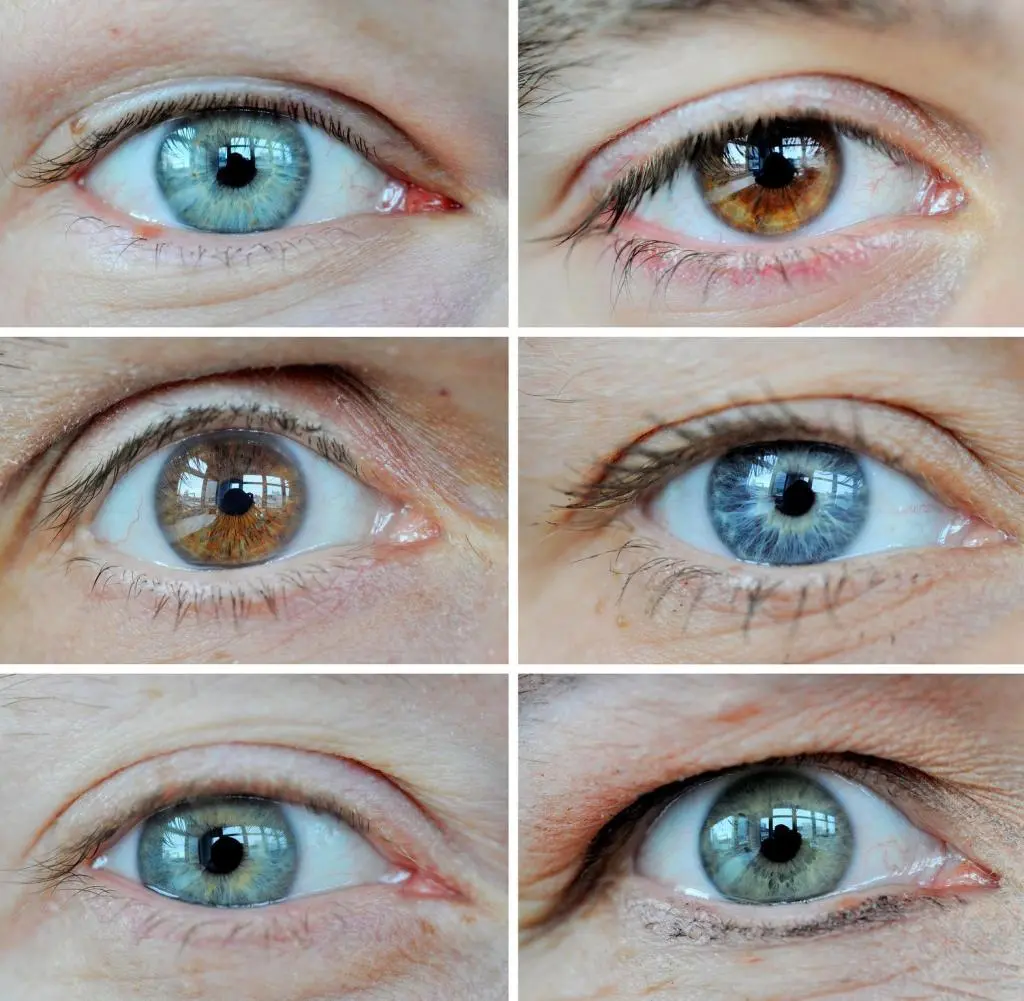 wie sieht ein blindes auge aus - Bin ich blind