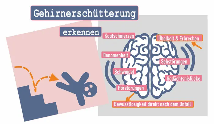 wann erbrechen bei gehirnerschütterung - Bis wann Erbrechen nach Gehirnerschütterung
