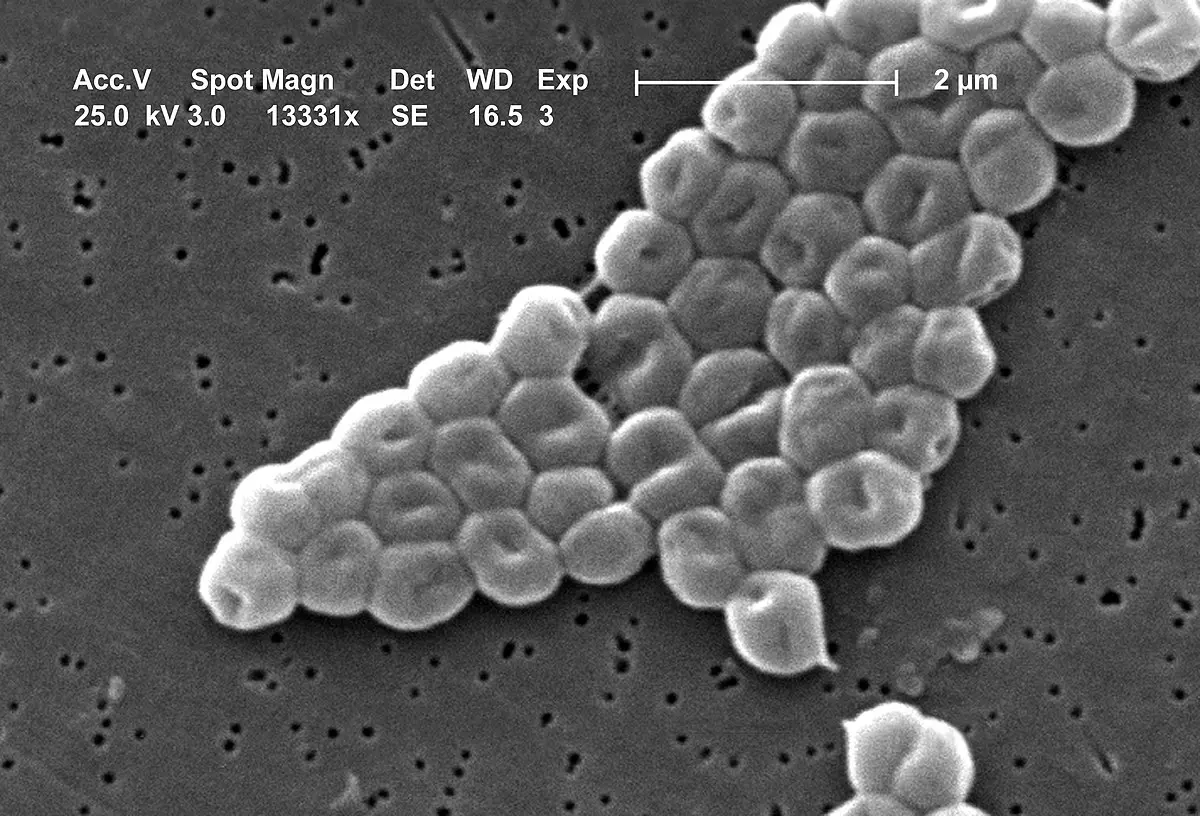 acinetobacter baumannii schwangerschaft - Ist Acinetobacter baumannii meldepflichtig