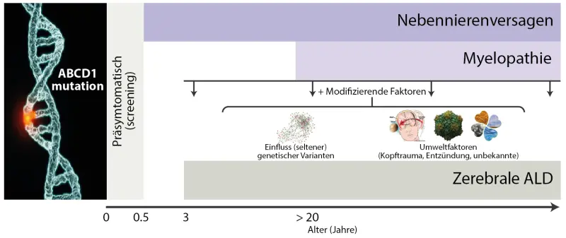 ald geburt - Ist Adrenoleukodystrophie heilbar