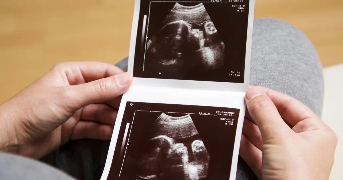 angelsound schwangerschaft - Ist ein Fetal Doppler schädlich für das Baby