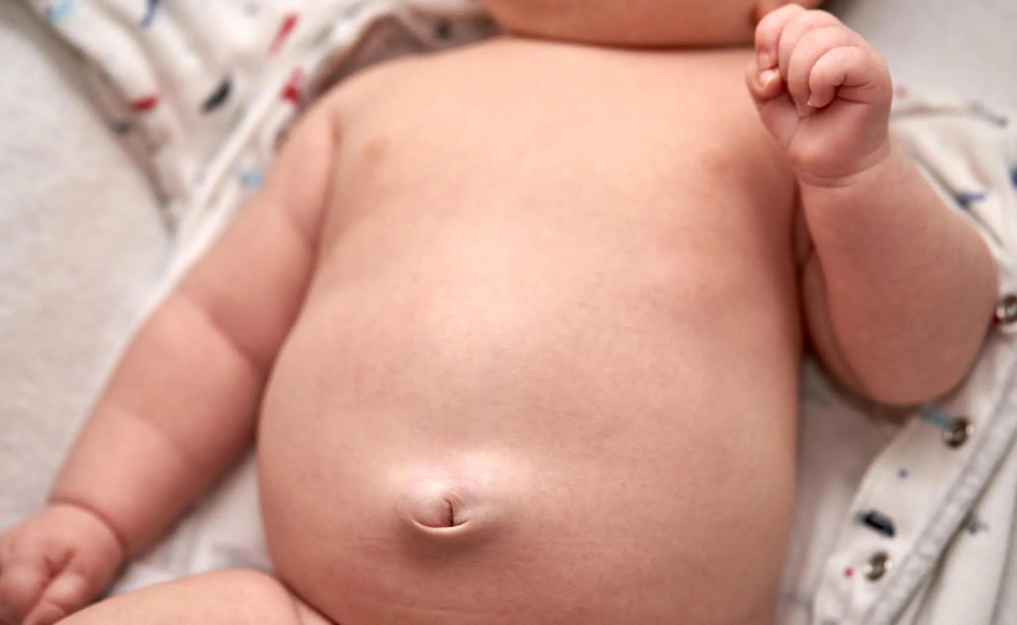 nabelbruch babys - Ist ein Nabelbruch bei Babys schmerzhaft