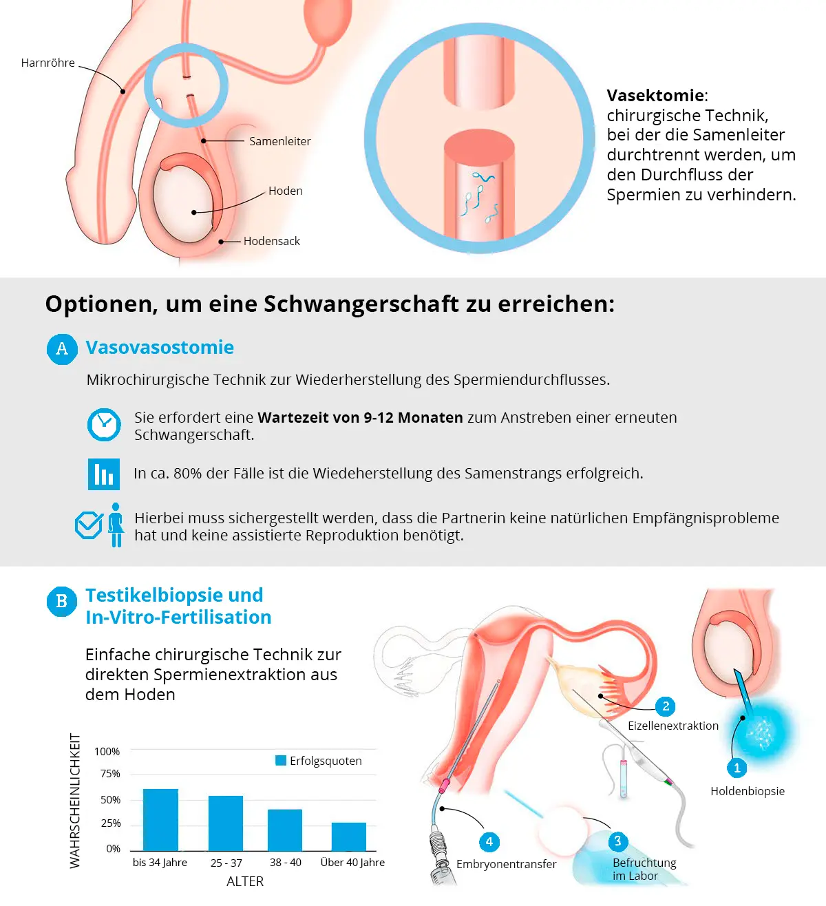 schwangerschaft trotz vasektomie - Ist eine Vasektomie zu 100% sicher