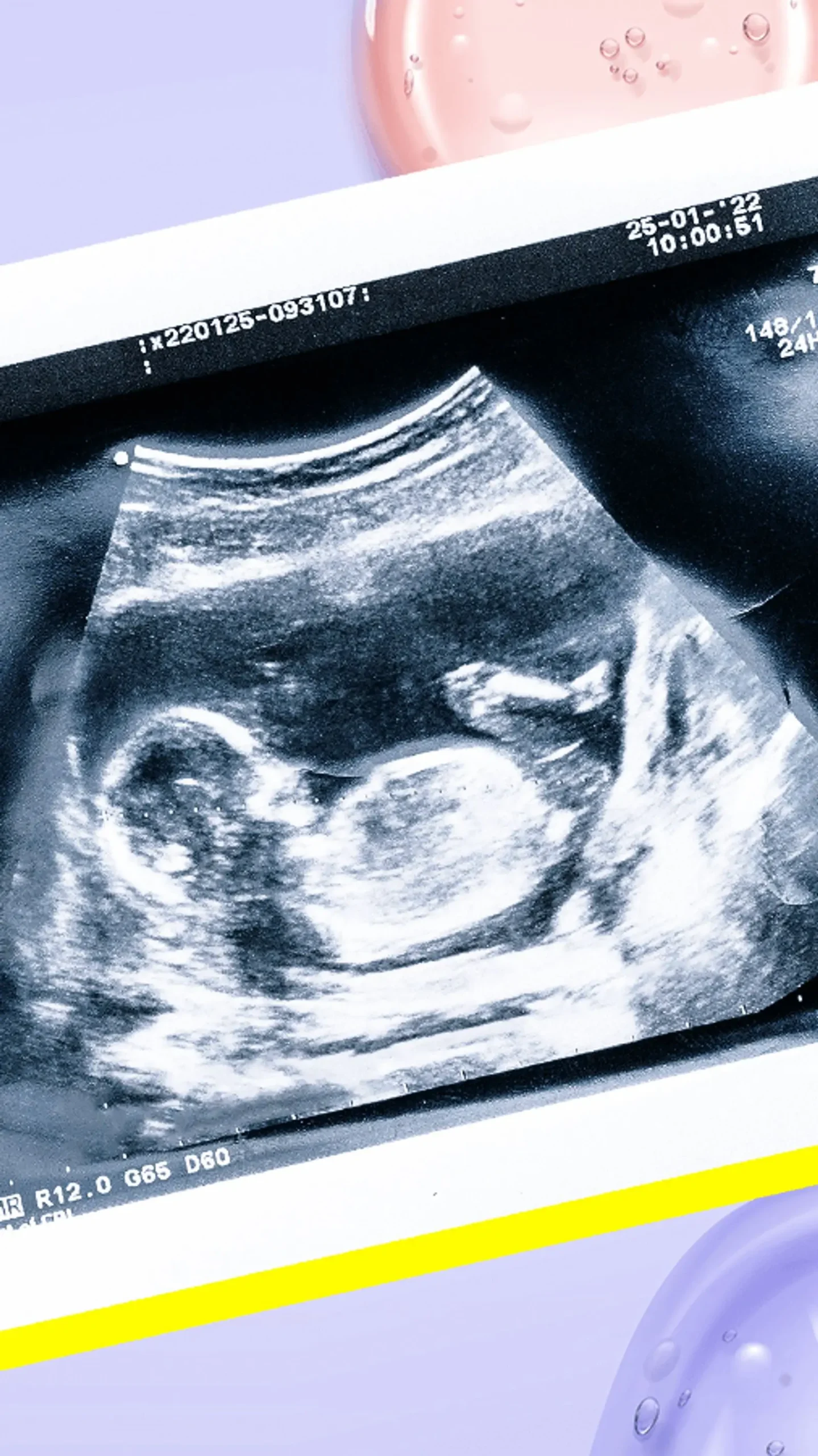 durex gleitgel schwangerschaft - Ist Gleitgel Durex essbar