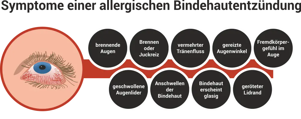 bindehautentzündung schwangerschaft hausmittel - Ist Kamillentee gut für Bindehautentzündung