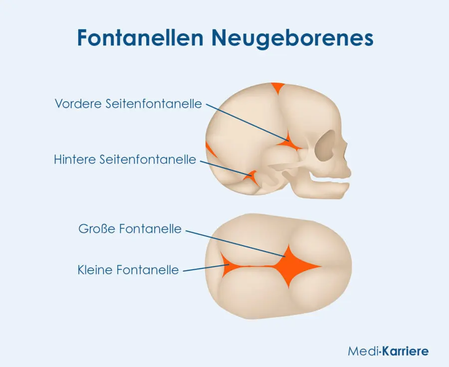 fontanelle bei geburt geschlossen - Ist Kraniosynostose eine Krankheit