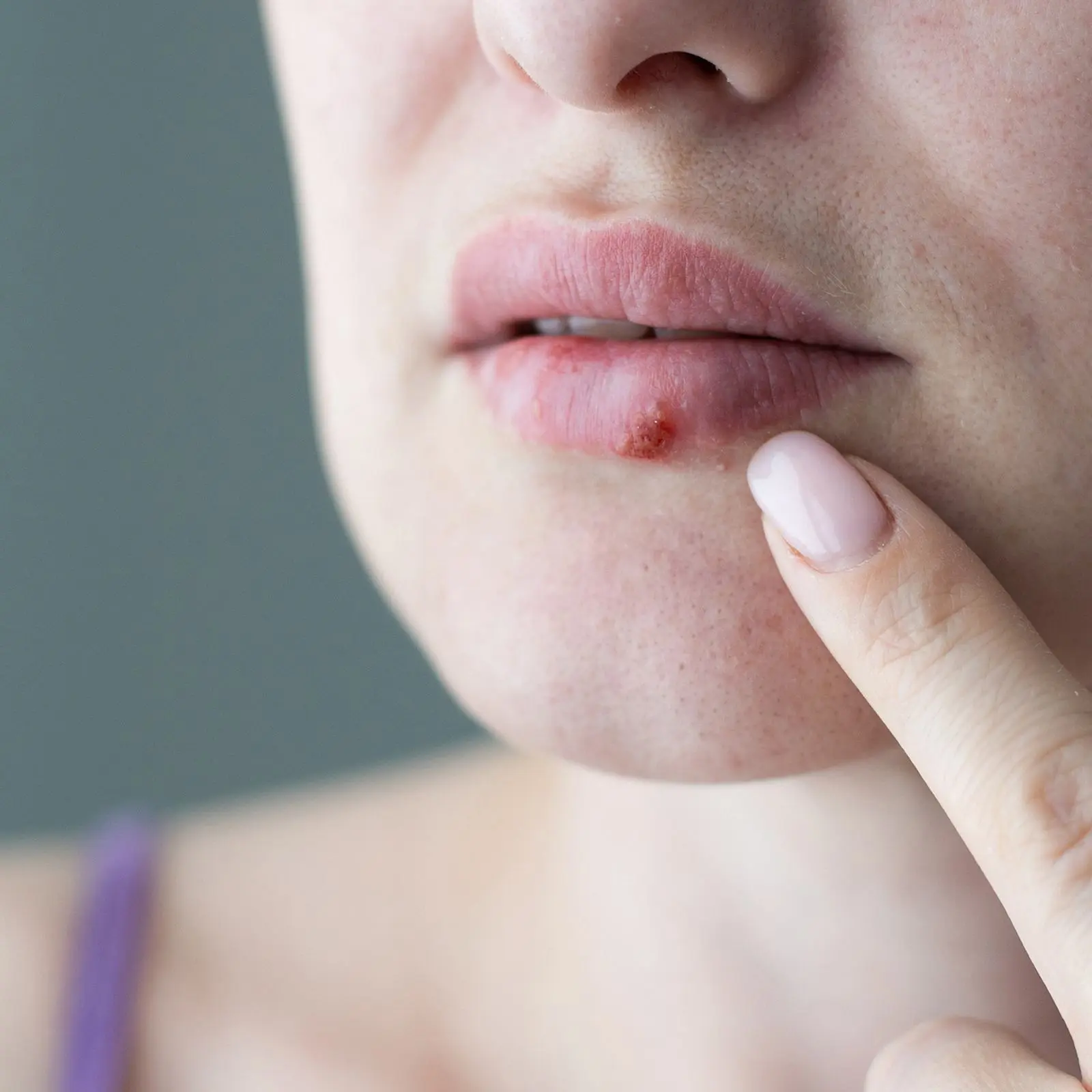 lippenherpes schwangerschaft gefährlich - Ist Lippenherpes schlimm in der Schwangerschaft