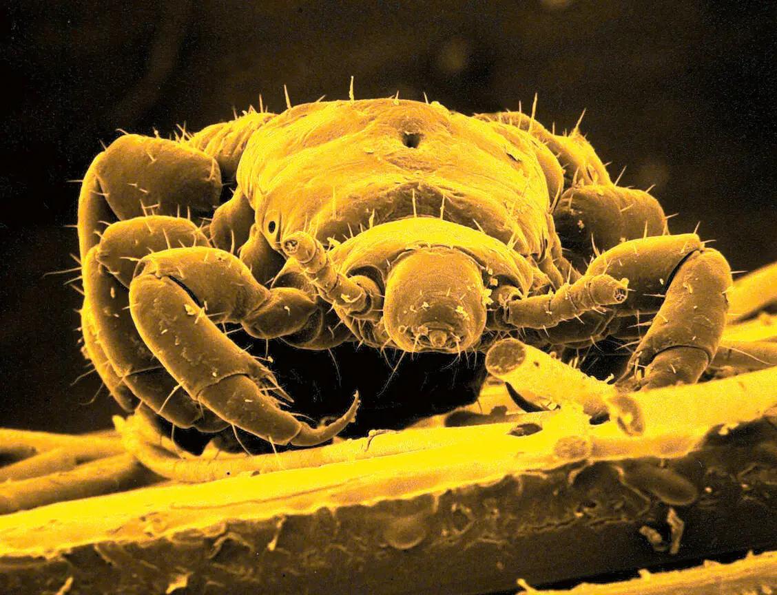 permethrin schwangerschaft - Ist Permethrin gefährlich für Menschen