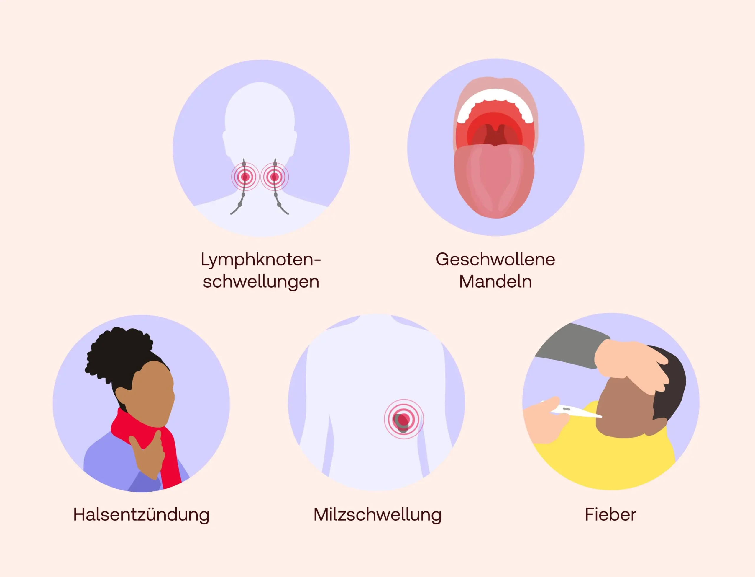 Pfeiffersches Drüsenfieber bei Kleinkindern: Was Eltern wissen sollten - Ist Pfeiffersches Drüsenfieber für Kleinkinder gefährlich pfeiffersches drüsenfieber kleinkind - Ist Pfeiffersches Drüsenfieber für Kleinkinder gefährlich