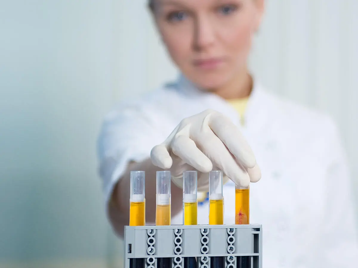 blut im urin nach geburt - Kann Blut im Urin von alleine weggehen