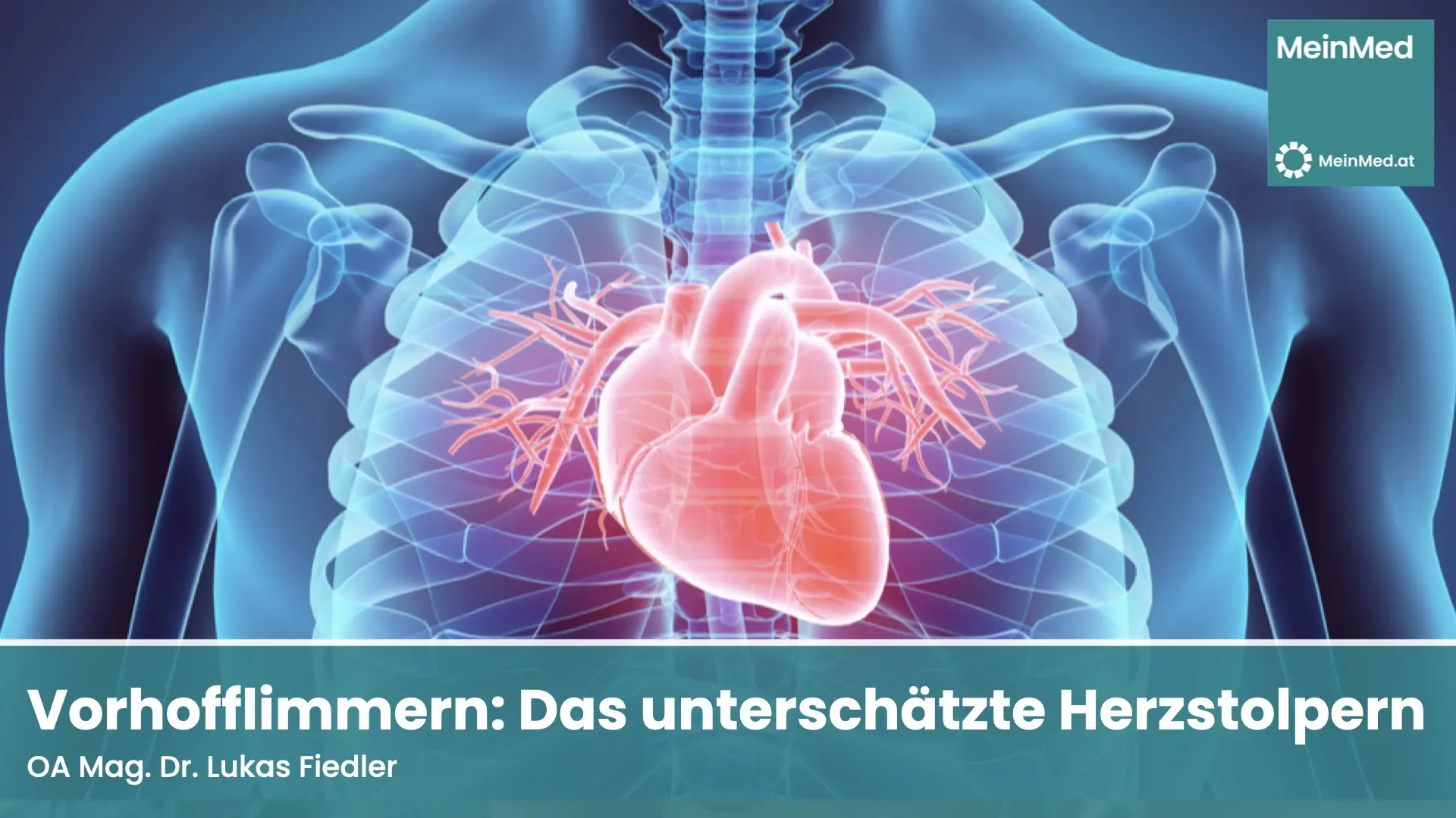 herzstolpern nach geburt - Kann Herzstolpern wieder verschwinden