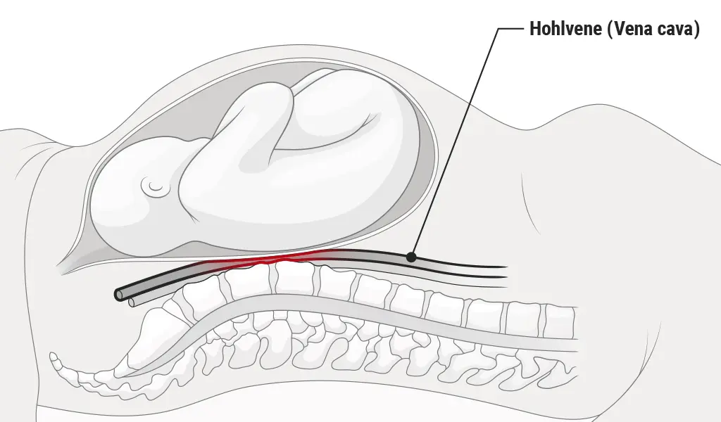 darf man auf dem bauch schlafen in der schwangerschaft - Kann ich mein Baby erdrücken wenn ich auf dem Bauch schlafe
