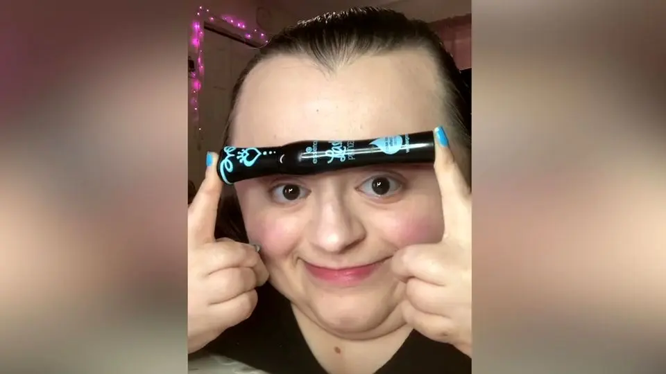 glasknochenkrankheit augen - Kann man Glasknochen heilen