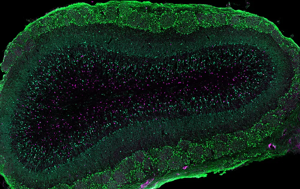 stammzellenspende schwangerschaft - Kann man in der Stillzeit Stammzellen spenden