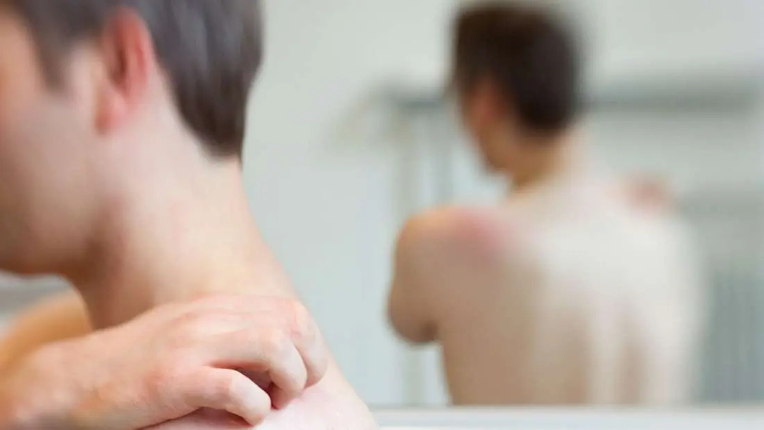 gürtelrose kurz vor geburt - Kann man mit 37 Gürtelrose bekommen