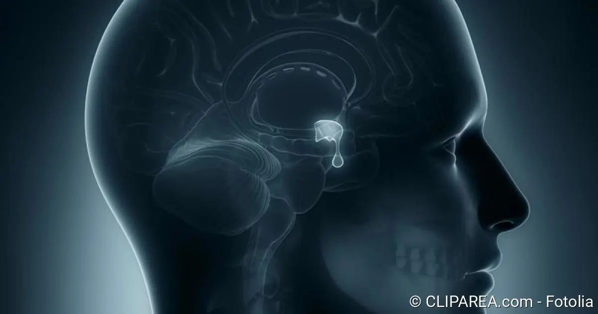 prolaktinom schwangerschaft - Kann man mit einem Prolaktinom stillen