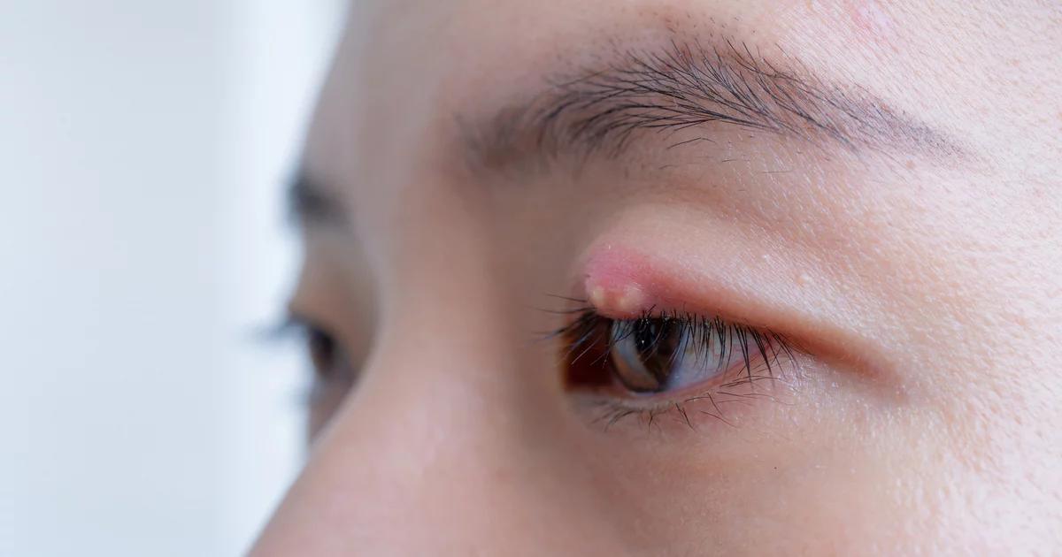 gerstenkorn kita - Kann man mit Gerstenkorn zur Schule