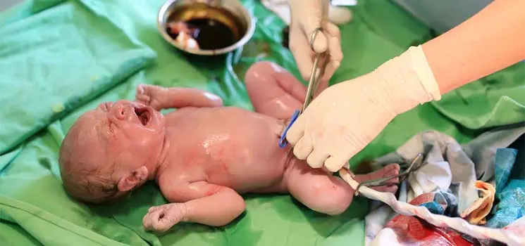 Stammzellen bei Geburt einfrieren: Eine Investition in die Zukunft? - Kann man seine eigenen Stammzellen einfrieren stammzellen bei geburt einfrieren - Kann man seine eigenen Stammzellen einfrieren