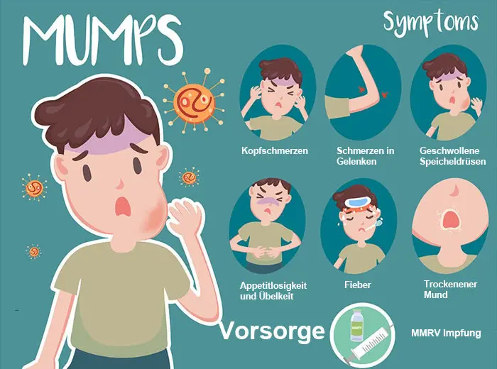 inkubationszeit bei mumps - Kann man sich mit Mumps anstecken wenn man geimpft ist