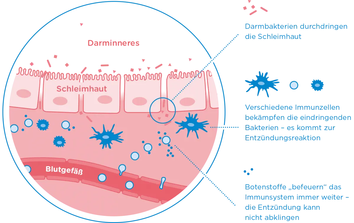 colitis ulcerosa geburt - Kann man trotz Colitis ulcerosa Kinder bekommen
