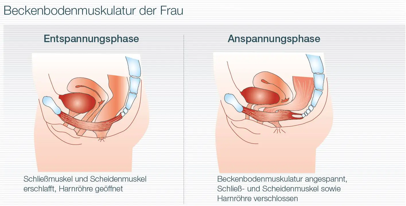 nach geburt urin nicht stoppen - Kann urinstrahl nicht stoppen