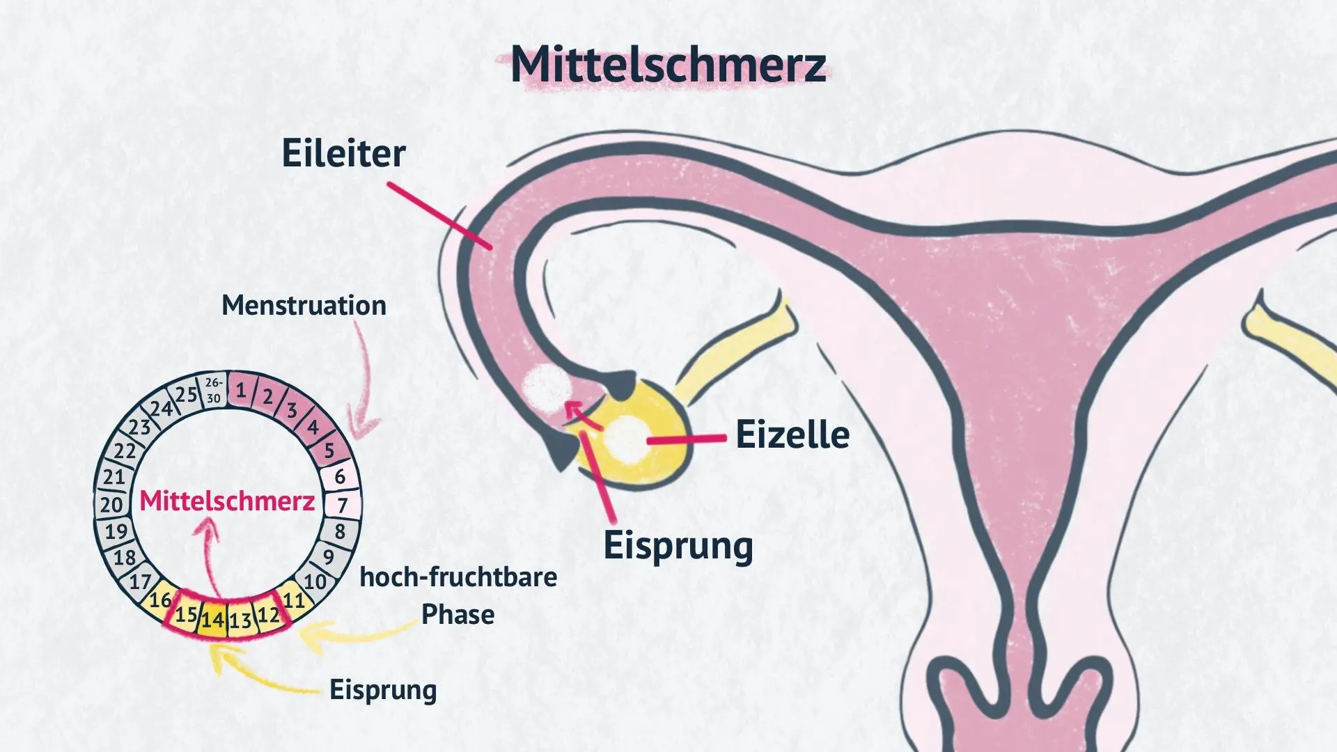 ziehen im unterleib vor eisprung - Kann vor dem Eisprung der Eierstock Schmerzen