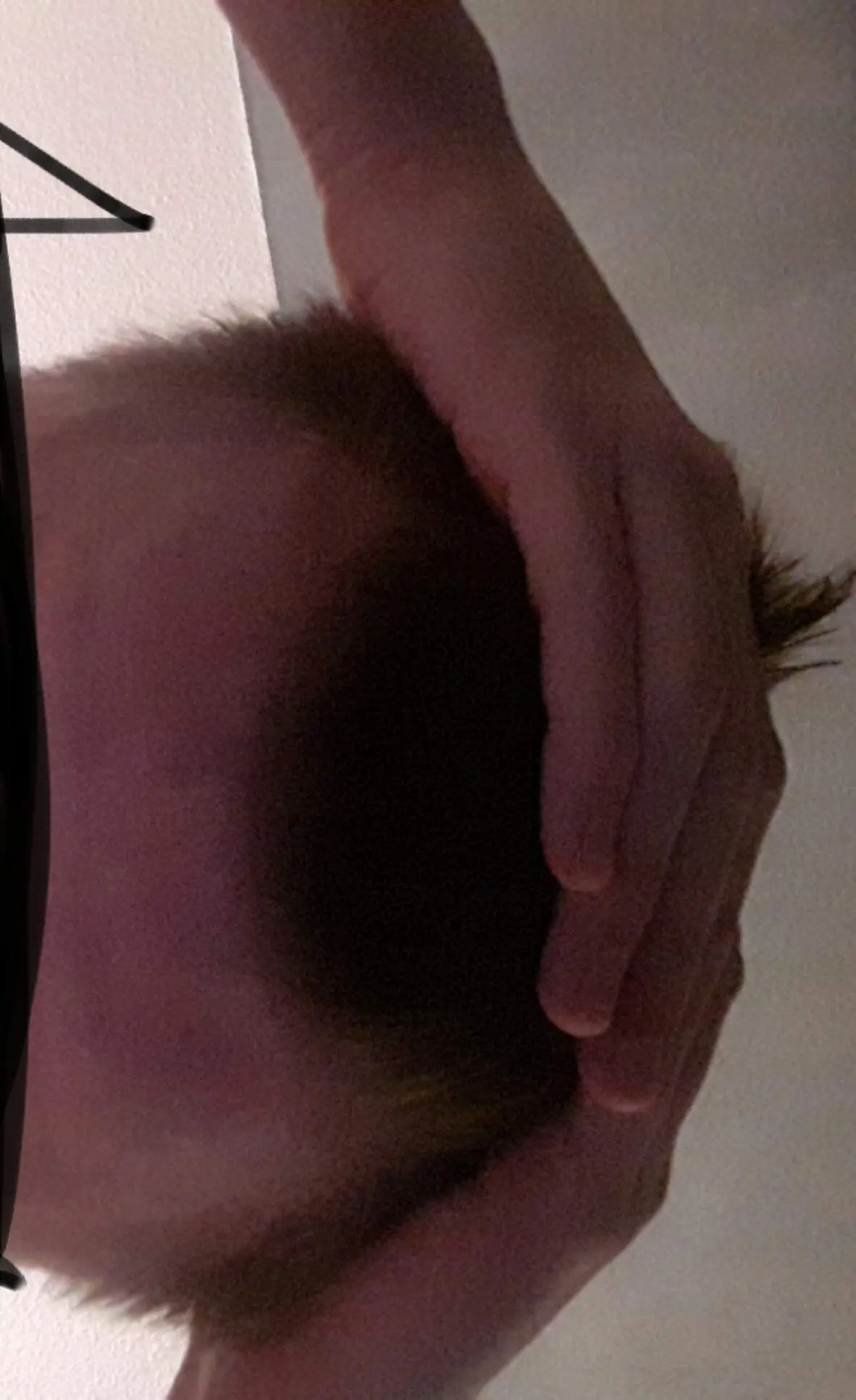 geheimratsecken nach geburt - Können Geheimratsecken wieder wachsen