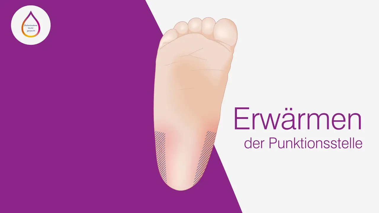 Fersenblutentnahme Hebamme: Alles Wissenswerte - Können Hebammen Blut abnehmen fersenblutentnahme hebamme - Können Hebammen Blut abnehmen