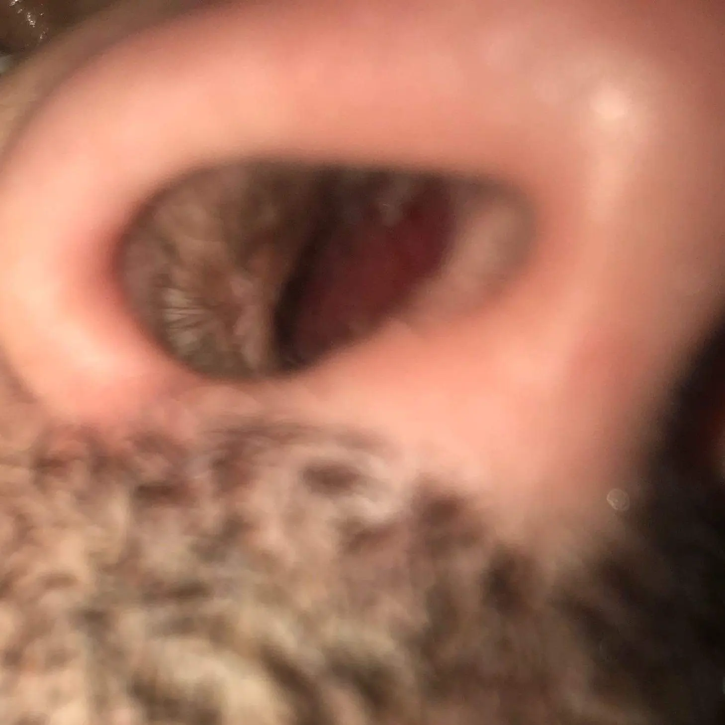 trockene nasenschleimhaut blutig - Können trockene Schleimhäute bluten