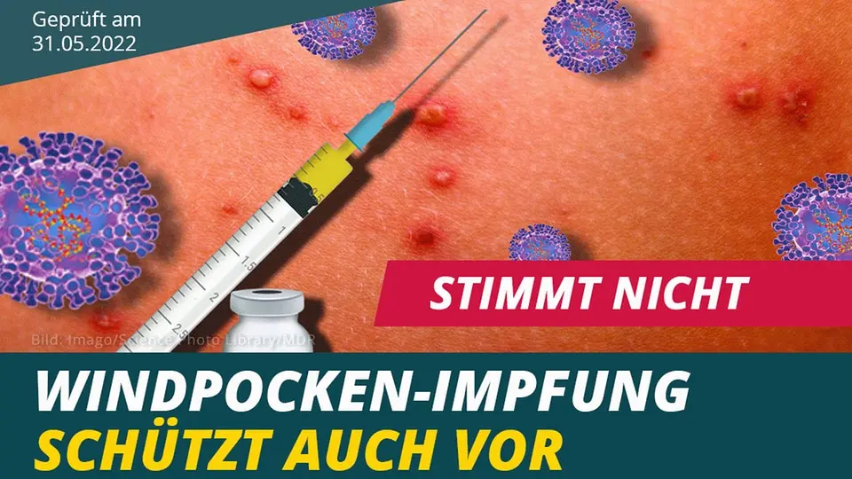 pocken ausschlag - Sind Windpocken und Pocken das gleiche