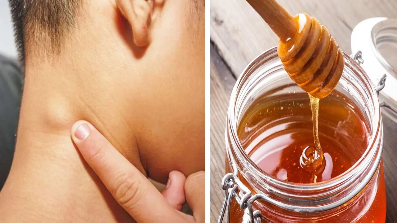 lymphknoten geschwollen hausmittel - Soll man geschwollene Lymphknoten massieren