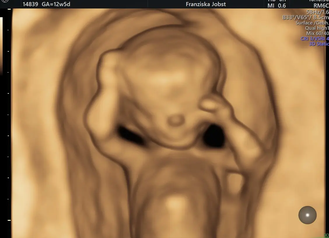 feindiagnostik schwangerschaft kosten - Wann bekommt man Feindiagnostik bezahlt