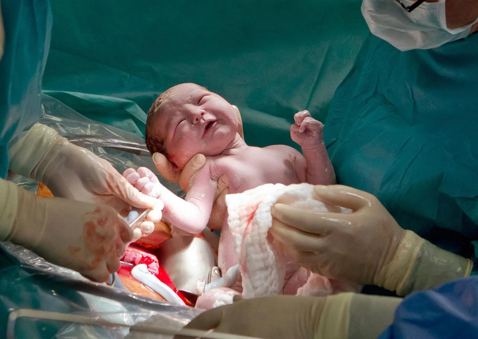 morphium geburt - Wann bekommt man Morphin im Krankenhaus