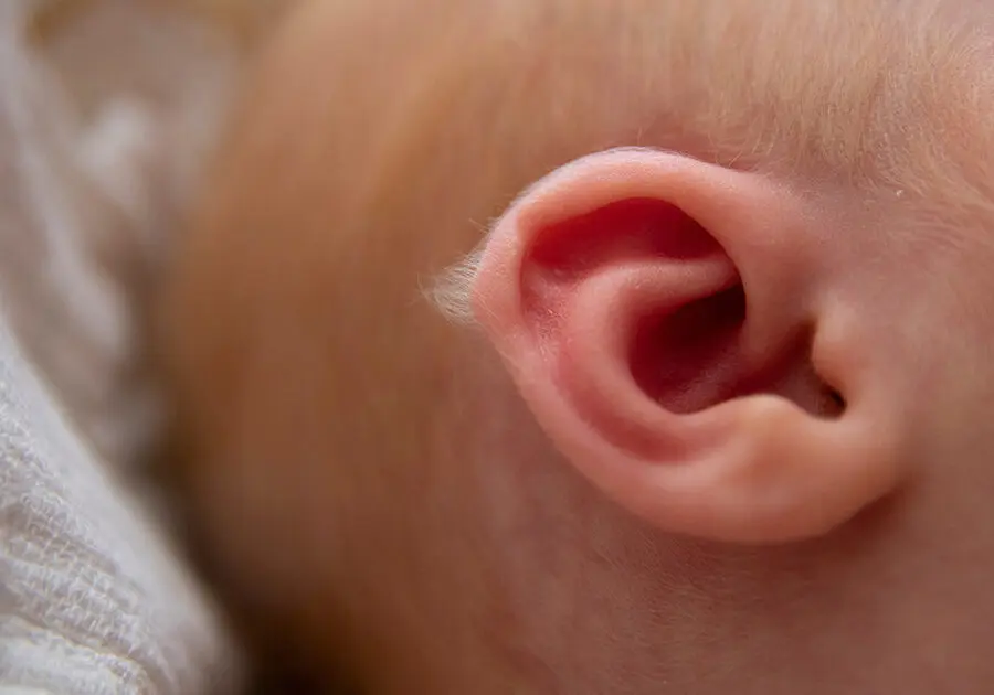 lanugobehaarung nach der geburt - Wann bekommt man Wollhaar