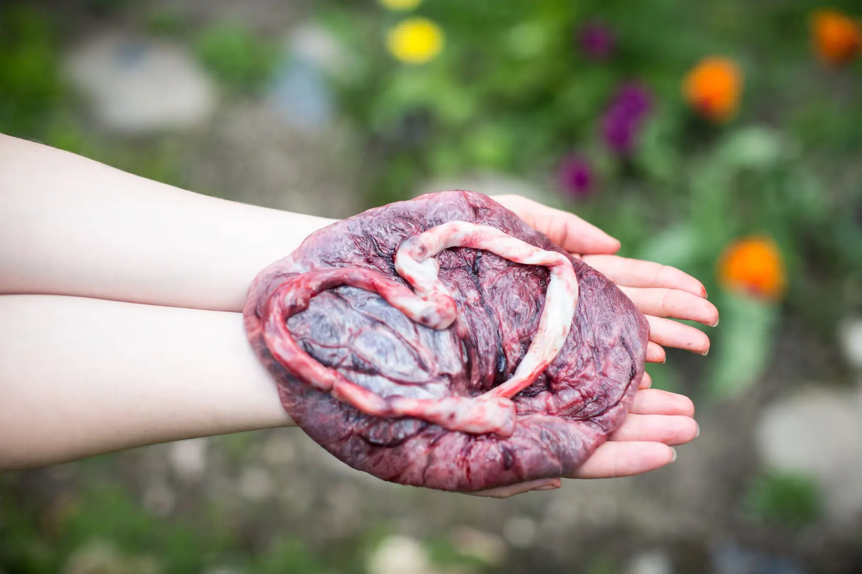 globuli nabelschnur - Wann C und wann d Potenz