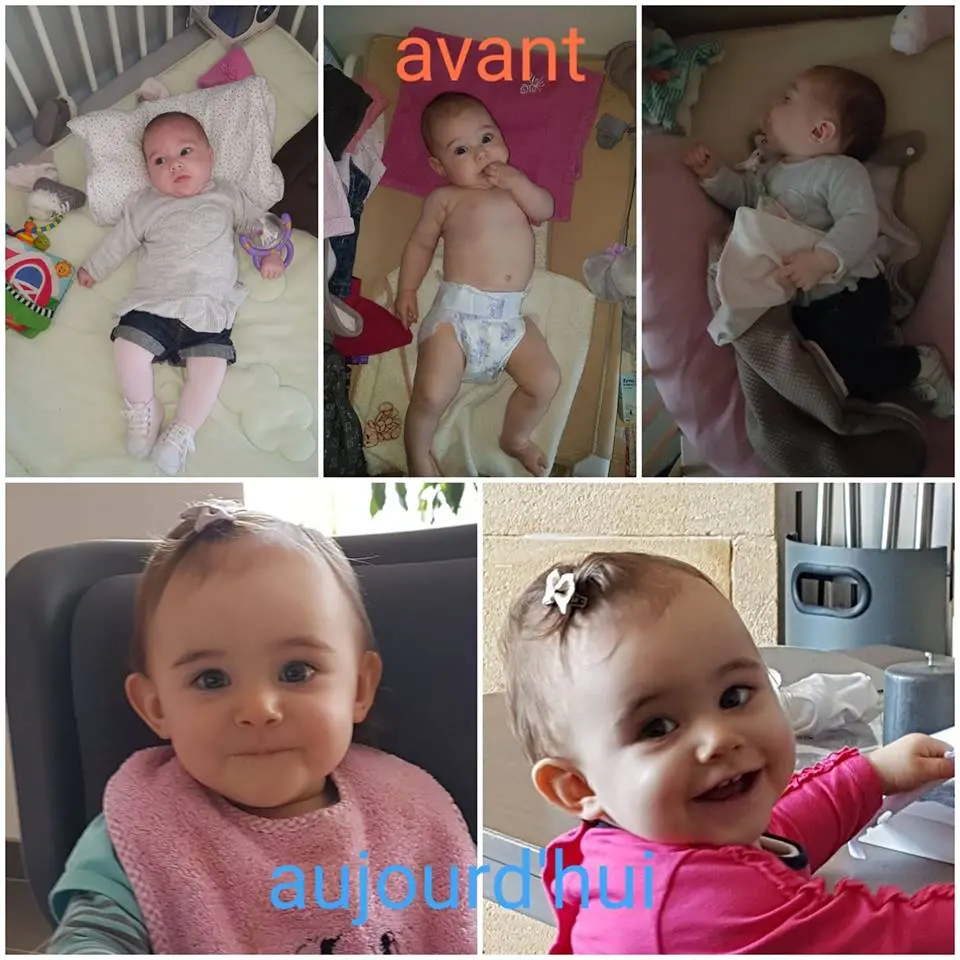 kiss syndrom babys - Wann entwickelt sich KiSS-Syndrom