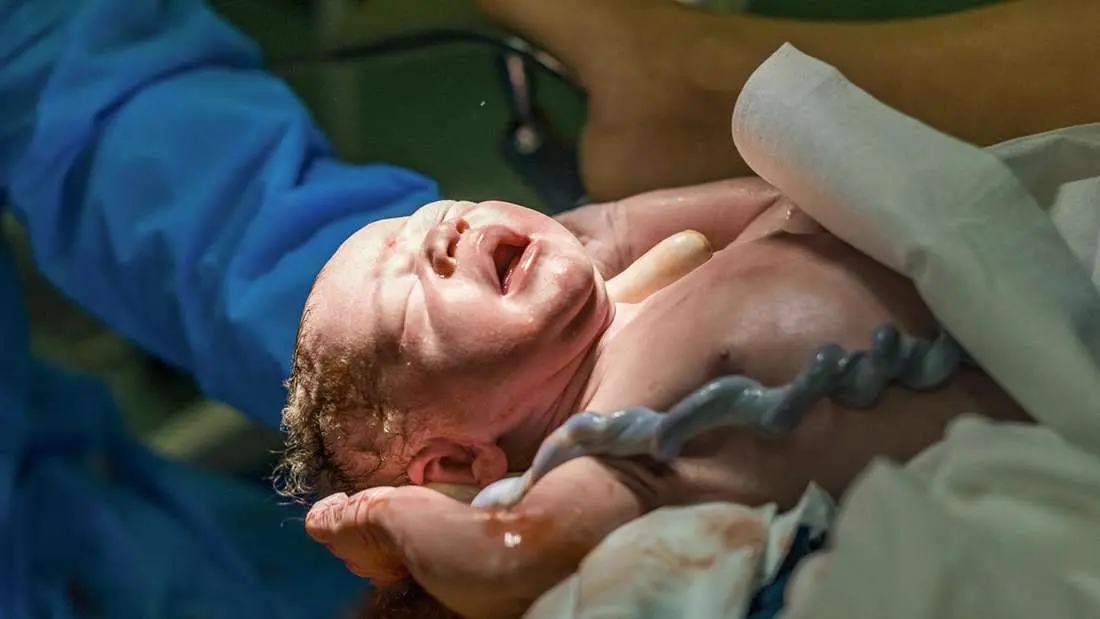 nabelschnur nach geburt - Wann fällt die Nabelschnur bei Neugeborenen ab
