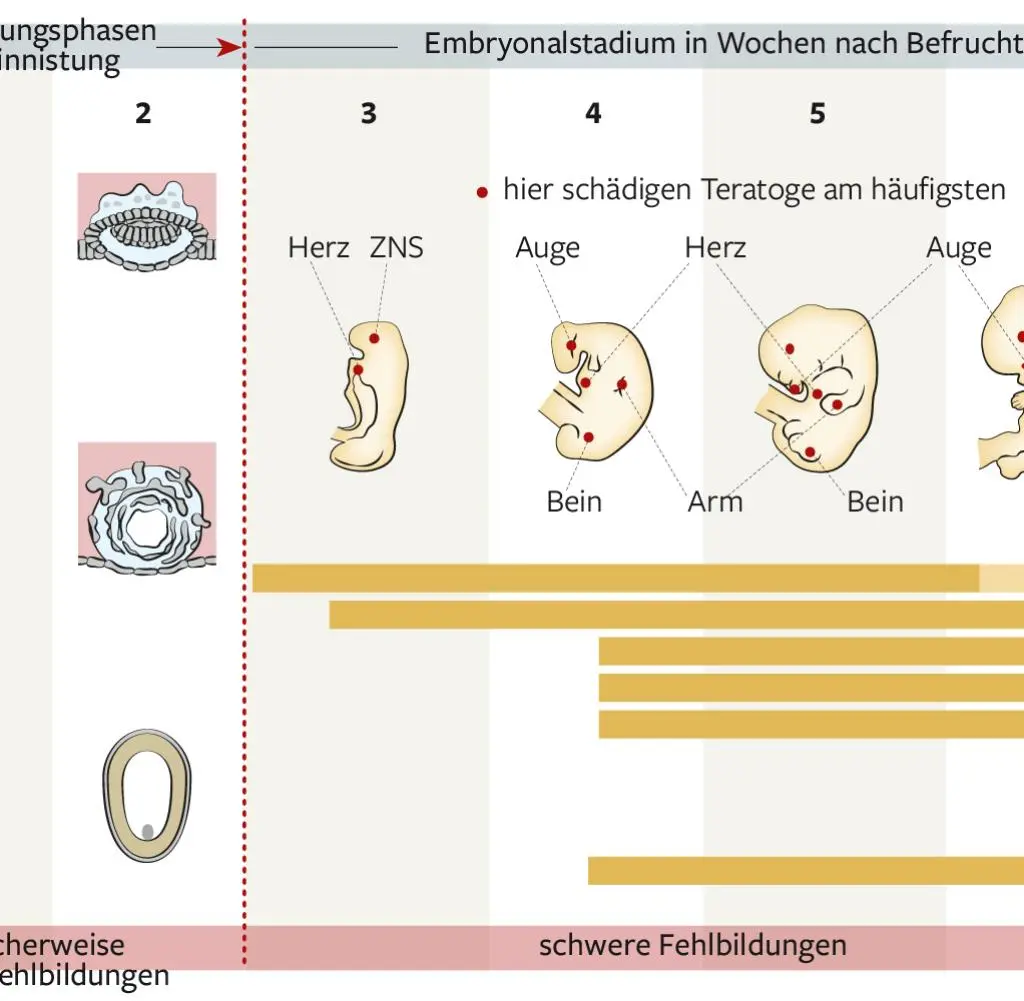 ab wann gilt eine schwangerschaft als risiko - Wann hat man eine Risiko SS