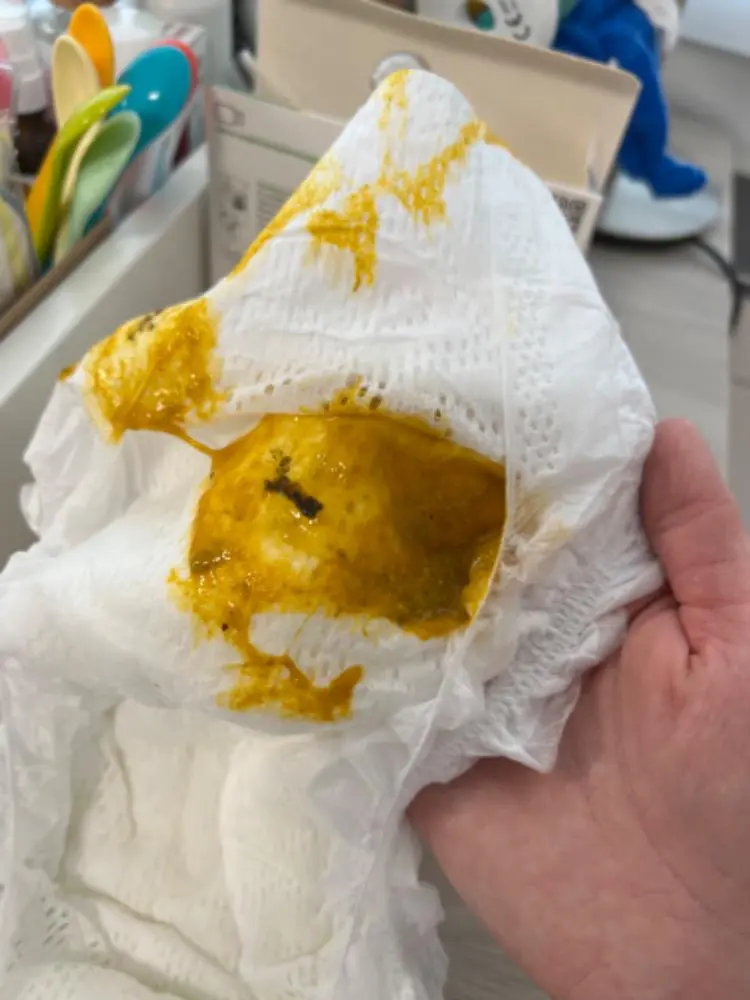 baby blut im stuhl - Wann ist Blut im Stuhl gefährlich Kind