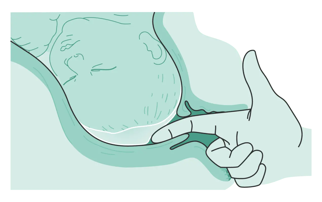 geburt einleiten nachteile - Wann ist eine Geburtseinleitung sinnvoll