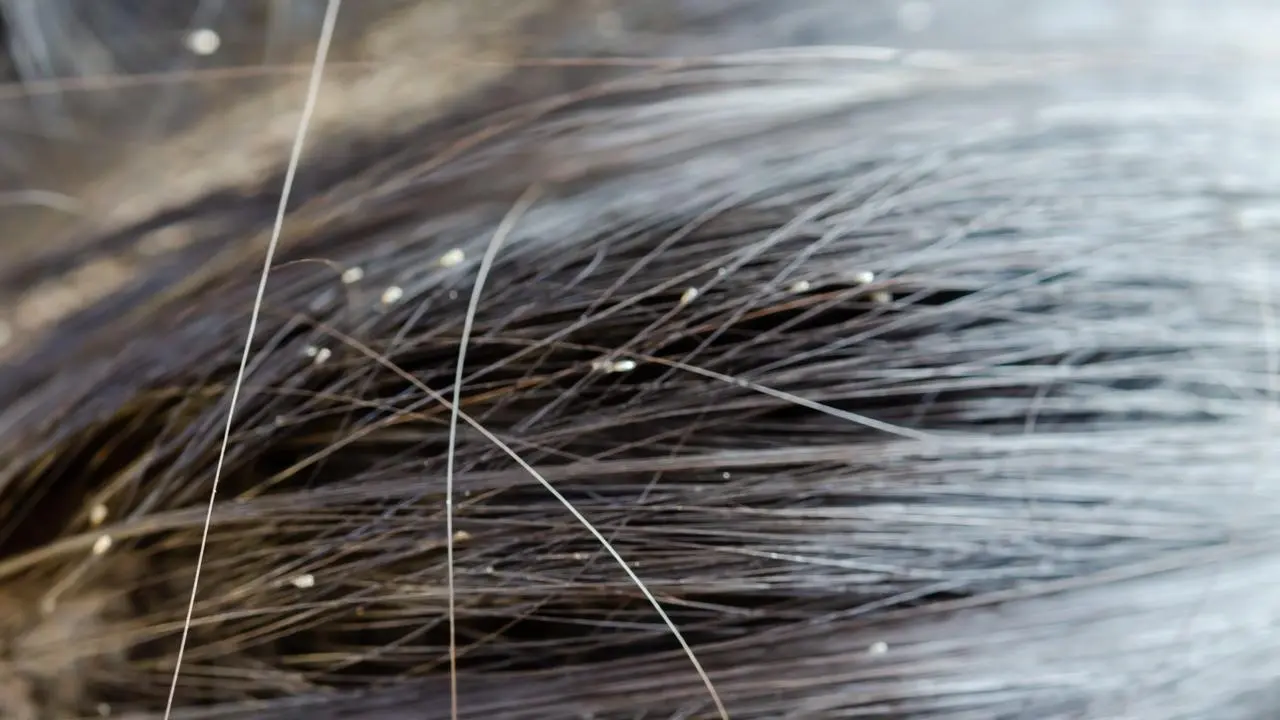 läuse bei kleinkindern - Wann nach Läuse wieder in die Kita