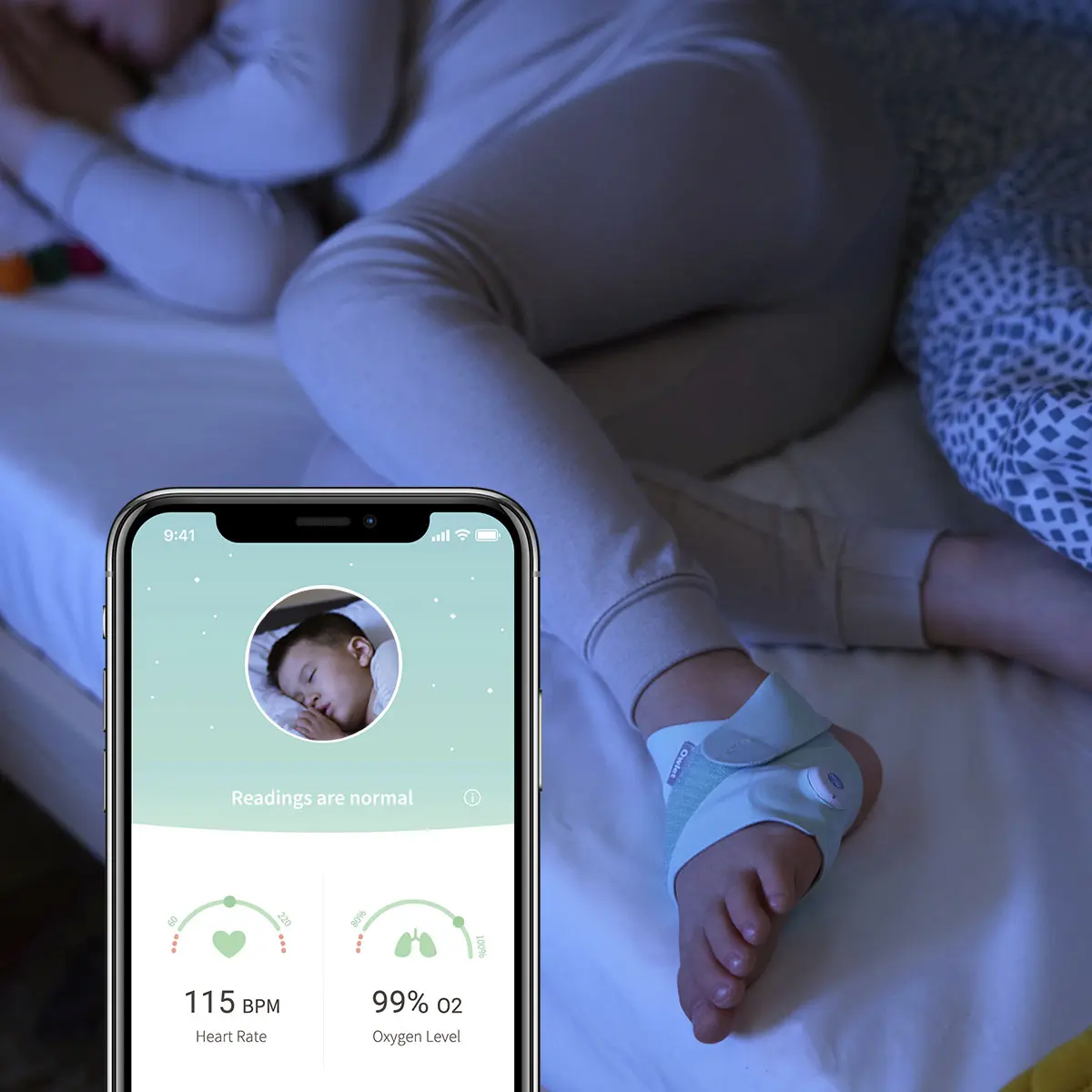 owlet smart sock - Wann schlägt owlet Alarm
