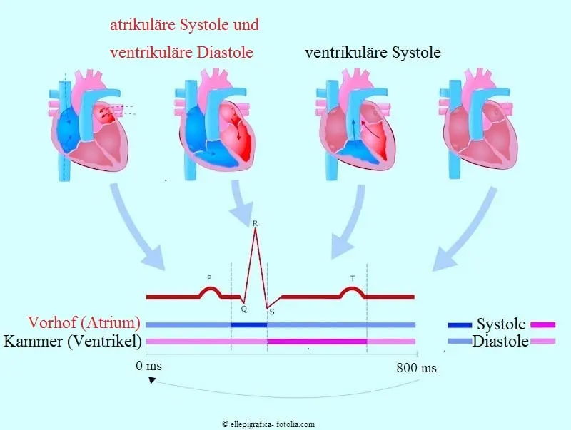 systolikum baby - Wann tritt ein Systolikum auf