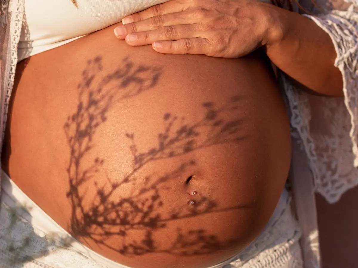 hyperpigmentierung schwangerschaft - Wann verschwindet Hyperpigmentierung