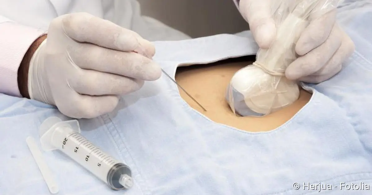 ab wann fruchtwasseruntersuchung - Wann wird die Fruchtwasseruntersuchung gemacht