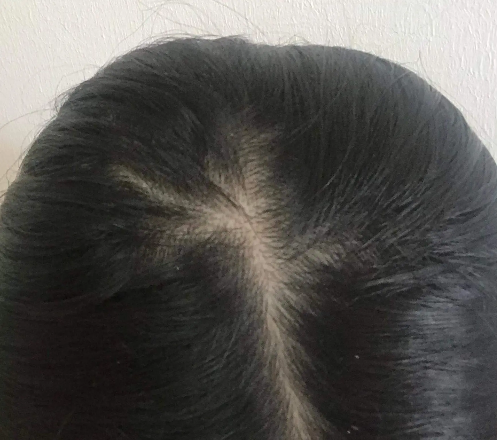 scheitel hinterkopf - Warum fallen die Haare am Hinterkopf auseinander