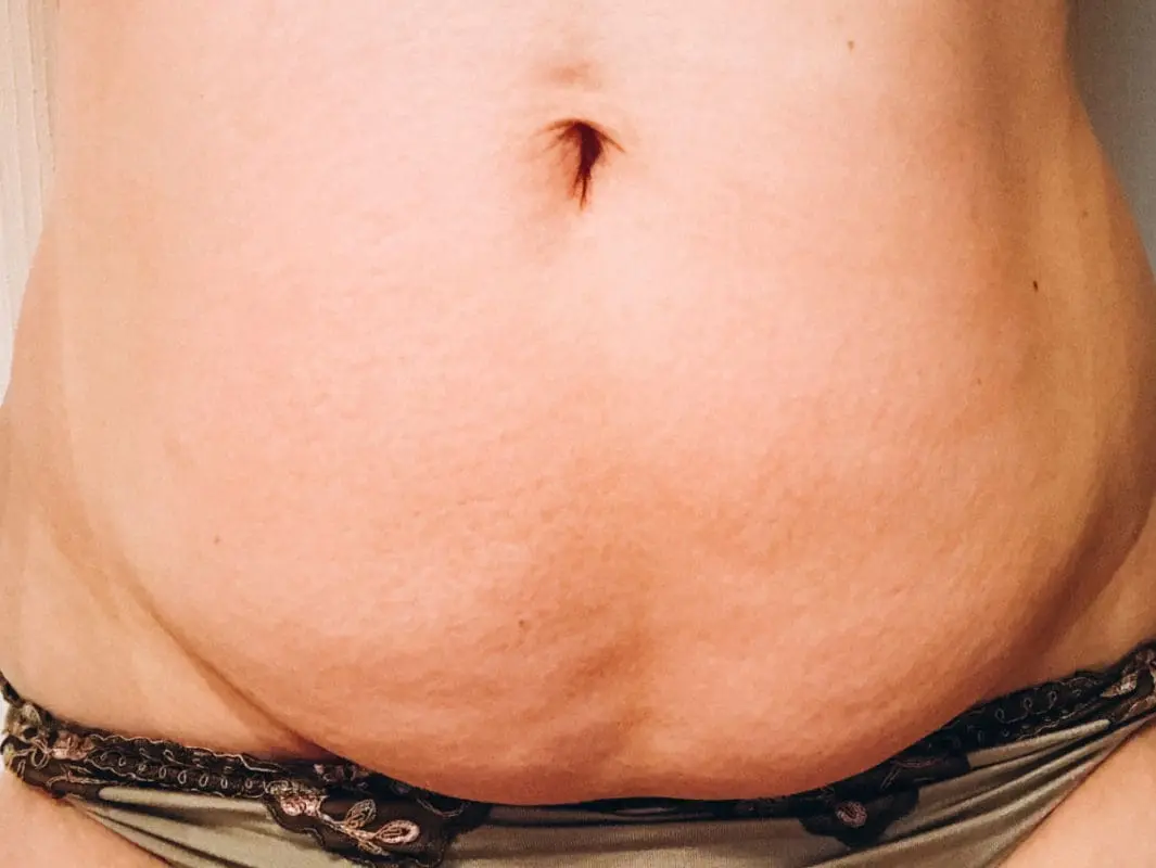 bauch bildet sich nach geburt nicht zurück - Warum ist der Bauch nach der Geburt noch so groß
