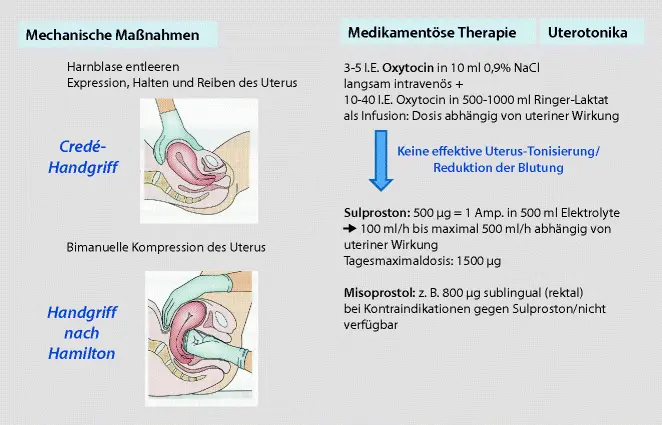 hoher blutverlust geburt folgen - Warum ist ein zu hoher Blutverlust lebensbedrohlich