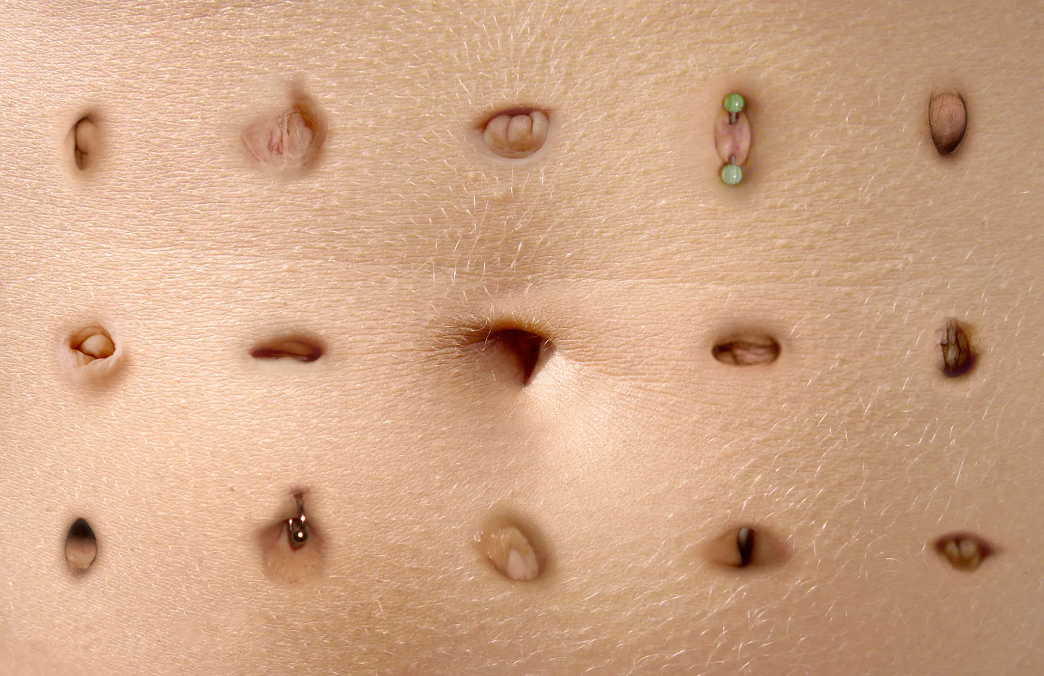 Wie Sieht Der Bauchnabel Aus Wenn Die Nabelschnur Abgefallen Ist Bauchnabel Riecht & Nässt: Ursachen & Behandlung | Hebamme FZ